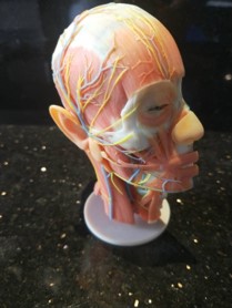 3D打印——毉療術前縯練